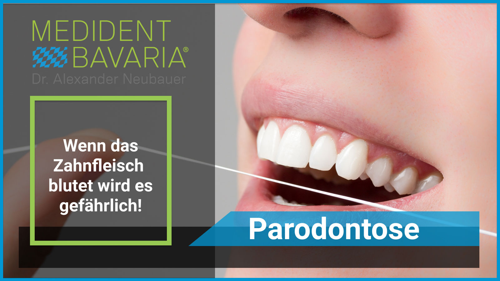 Parodontose - wenn das Zahnfleisch blutet, dann wird es gefährlich!